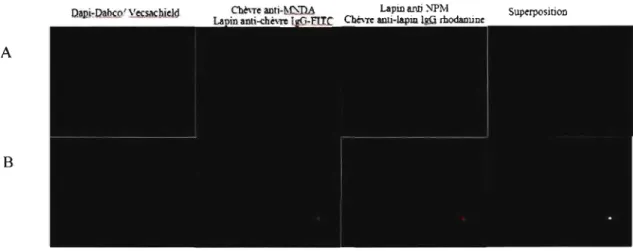 Figure 4  :  Image de déconvolution  indiquant la colocalisation cellulaire de MNDA et NPM  par la technique d'immunofluorescence dans les cellules HL-60