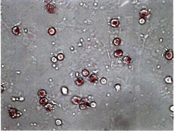 Figure  6  :  Coloration  au  Neutral  Red .  Les  cellules  ayant  adhérées  sont  colorées  après  la  mise en culture de  la  couche de cellules mononuclées blanches du  sang suite à  la  séparation  aux gradients de Ficoll