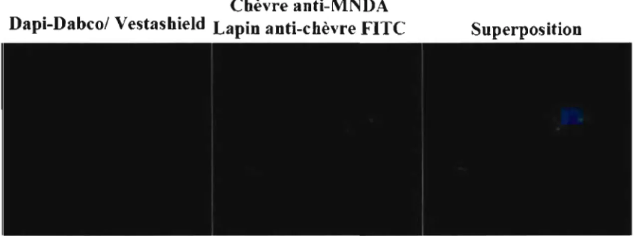 Figure 7 : Détection de MNDA par la technique d'immunofluorescence dans  les  monocytes  primaires  isolés avec la technique de gradient au  Ficoll