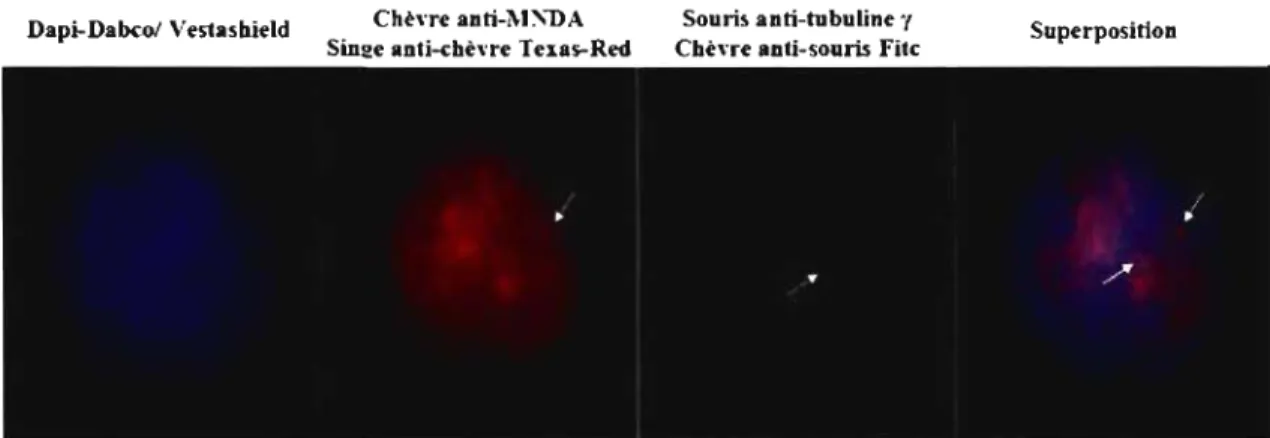Figure  9  :  Image d'immunofluorescence de  la  double détection  de  MNDA  et de  la  tubuline  gamma  sur  les  monocytes  primaires