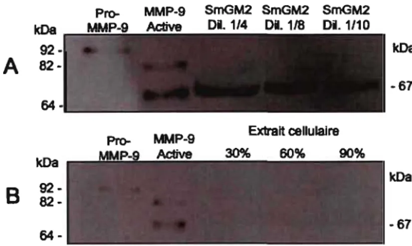 Figure 2.4.  Détection de  MMP-9 dans le milieu de culture complet et dans les CMLBH  cultivés dans un  milieu sans sérum