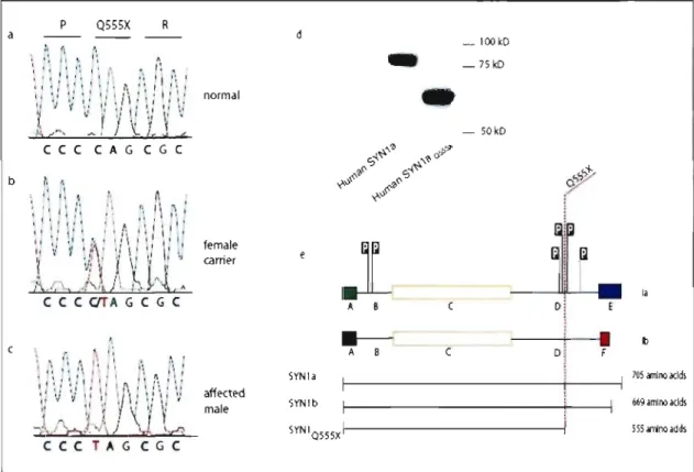Figure 4:  The Q555X mutation in  SYNl 