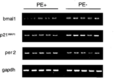 Figure 4:  Validation par PCR semi-quantitative des résultats obtenus par les micropuces  Affymétrix