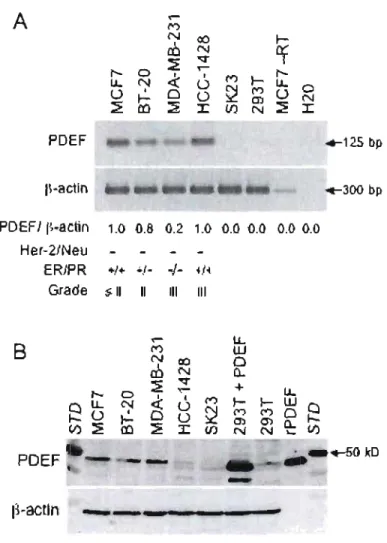 Figure  lm  PDEF rnRNA and protein expression in cancer celilines. 