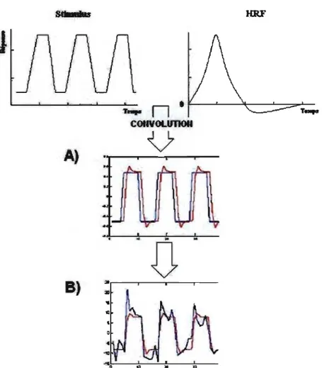 Fig.  8  - A)  Le  modèle  du  stimulus  est  convolué  avec  la  fonction  de  la  réponse  hémodynamique