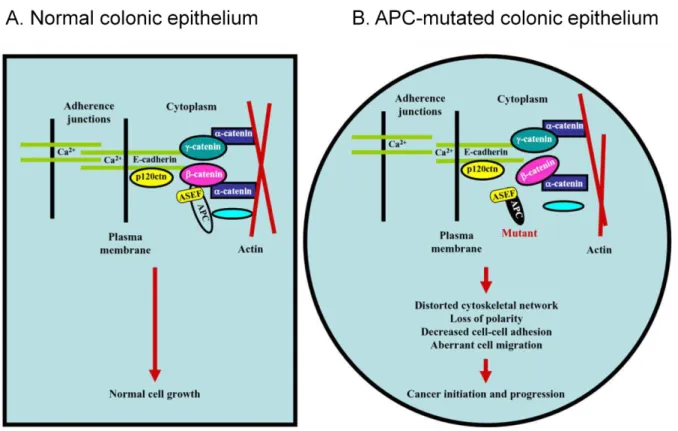 Figure 8. Model for cytoskeletal network in A) normal colonic epithelium and                      B) APC-mutated colonic epithelium ([66] with modifications)