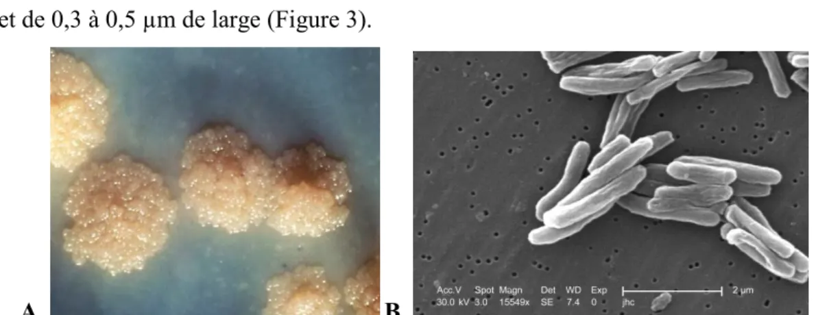 Figure 3: A. Colonies de Mycobacterium tuberculosis, B. Visualisation de Mycobacterium tuberculosis au  microscope électronique 