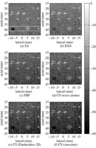 Figure 2.2: Result from [ Schiffner 2012 ]. (a) synthetic aperture (SA; 128 emissions, each of them is emitted from an element and received by all the elements [ Jensen 2006 ]) result with the region of interest indicated, (b) delay and sum, (c) filtered backpropagation [ Jensen 2006 ], (d)-(f) CS results with sparsifying basis of wave atoms, Daubechies-20 and curvelets.