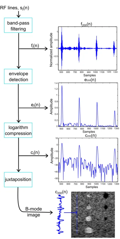 Figure 1.8: Reconstruction of B-mode image from RF signals. Intermediate data is illustrated in the right side of the figure.