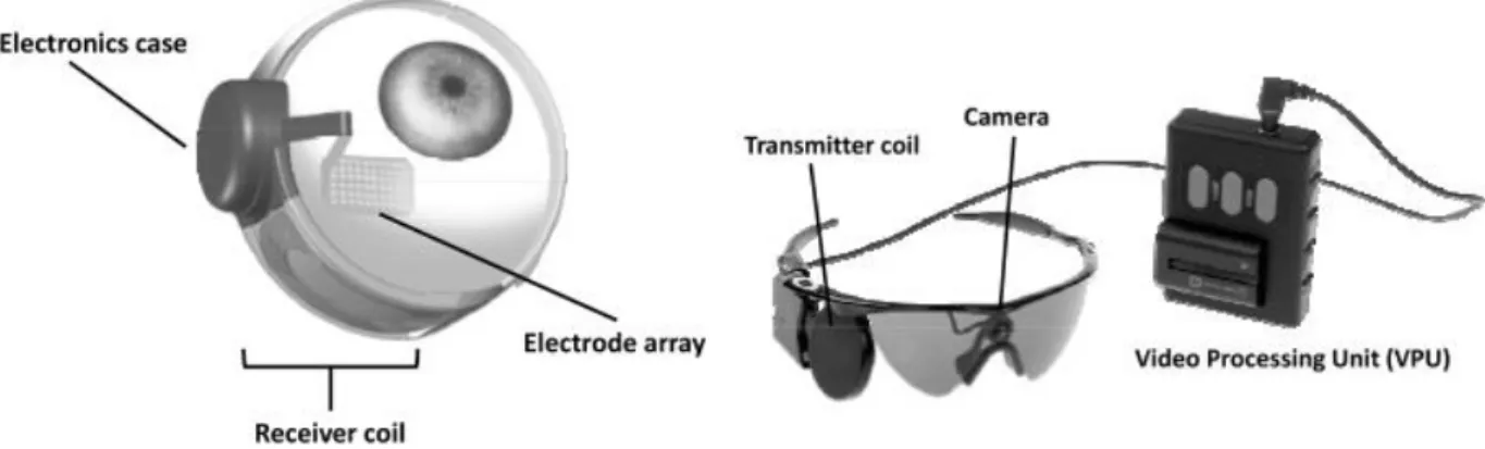Figure 1-12 L’implant épirétinien développé par la société Second Sight. 