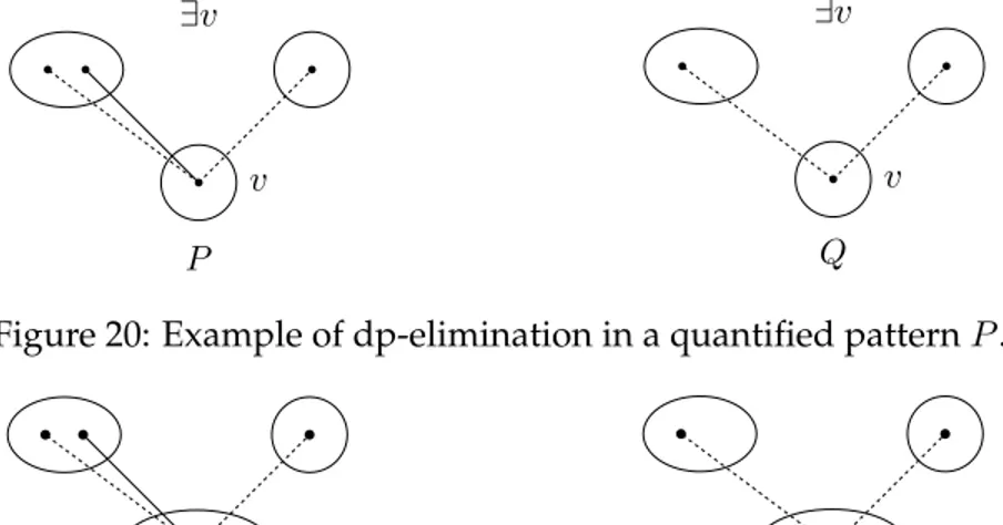 Figure 20: Example of dp-elimination in a quantified pattern P .