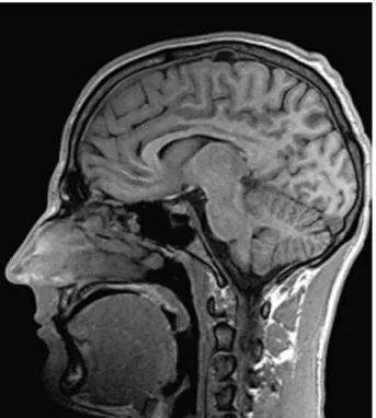 Figure 1.4 – Coupe sagittale de la tˆ ete en imagerie par r´ esonance magn´ etique [ Prince et Links ,