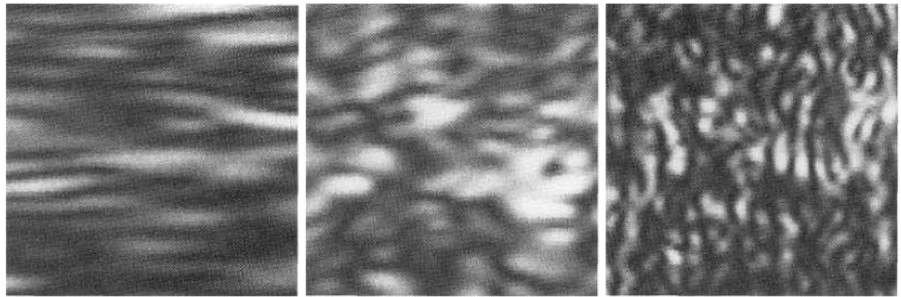 Figure 1.11 – Comparaison de trois images ultrasonores contenant le mˆ eme speckle obtenues avec des transducteurs diff´ erents, issue de [ Foster et al