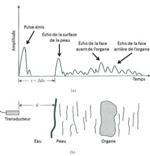 Figure 1.18 – Le signal ultrasonore classique en mode A adapt´ e de [ Prince et Links , 2006 ]
