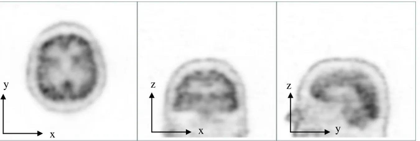 Figure 3-2 Volume de la distribution du traceur d’une perfusion cérébrale, visualisé sous les  plans axial, coronal et sagittal