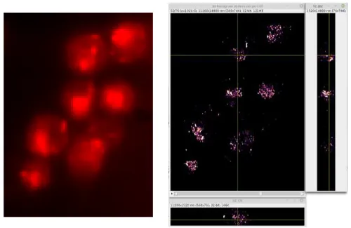 Figure 1.2: Image d’un même échantillon obtenu au microscope champ large standard (gauche) et en utilisant le procédé de localisation de molécule unique (droite)