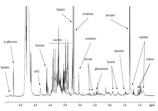 Figure 2.5 – Example of an annotated mixture spectrum. There are overlaps between peaks of lipides and valine and between the peaks of glutamine and lysine.