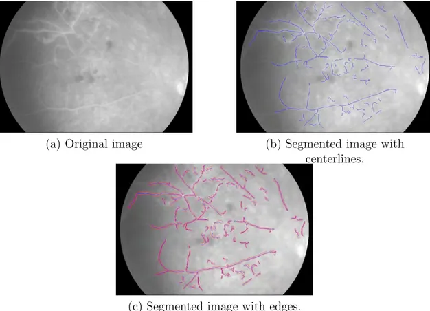 Figure 3.5: The segmentation for one abnormal image, which shows some mistakes.