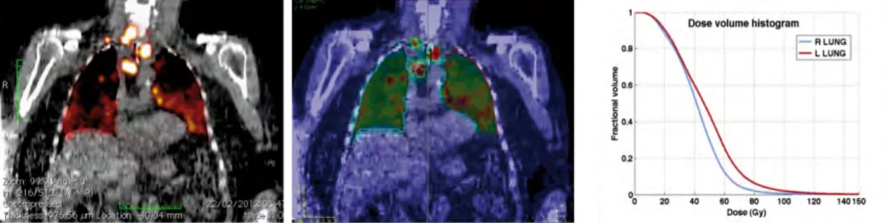 Figure 1.10: Patient-speciﬁc dosimetry obtained with the RAYDOSE software (Marcatili et al.