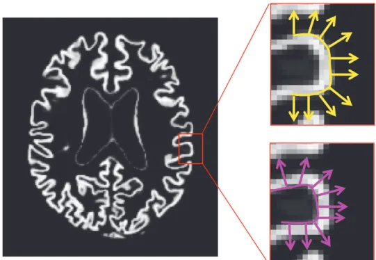 Figure 8.a : Le vecteur  ࢠ est le vecteur unitaire normal à la surface corticale et orienté vers l’extérieur  du  cortex  (i.e