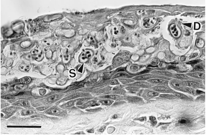 Figure 8-1- Histological section of severely infected digital skin of a wild Australian frog, 