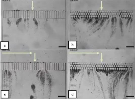 Figure 1.15: Observation of bacterial development for four different conditions after 2 h  filtration