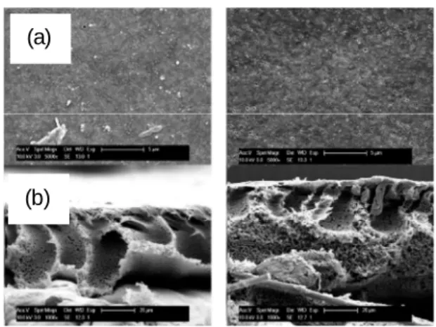Figur e 4: Surface (a) and cross-sectional (b) SEM morphology of reference (left) and M SP  (right)  membrane, showing absence of a significant change in the membrane morphological structure 