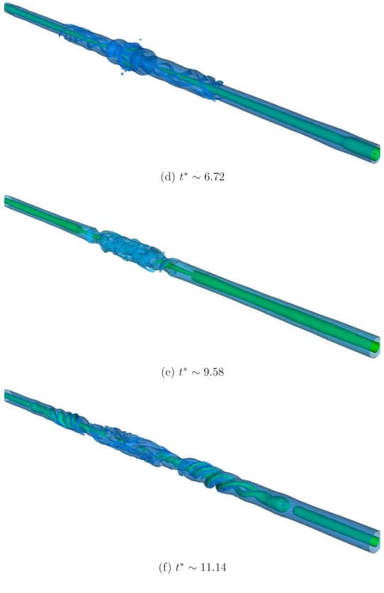 Fig. 3.17 – Illustration du phénomène de vortex bursting par la visualisation de l’évolution