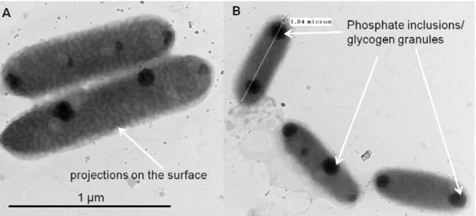 Fig. I. 15. TEM images of cyanobacteria Synechococcus sp. (A) Projections on their  surface; (B) Phosphate inclusions / glycogen granules