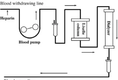 Figure 1.15: Schematic representation of dialysis line with integrated Lixelle column [3].
