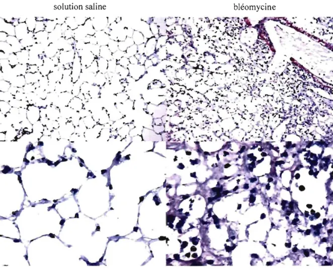 Figure 20  : Effet de la  bléomycine sur l'histologie chez les souris WT 