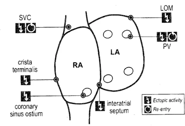 Figure 3.  Localisation des structures impliquées dans l'initiation de la fibrillation  auriculaire chez J'humain