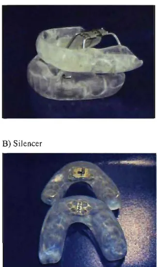 Figure 2.  A) The Klearway advancement mechanism  is  located  in  the palatal  area.  8) The Silencer advancement mechanism is situated in  the  incisor tooth area