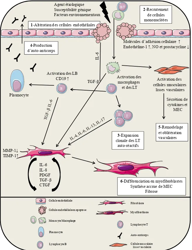 Figure 2. Modèle pathophysiologique de la sclérose systémique. Agent étiologique Susceptibilité géniqueFacteurs environnementaux 2-Recrutement de cellules mononuclééesActivation des macrophages et des LT 6-Différenciation en myofibroblastes