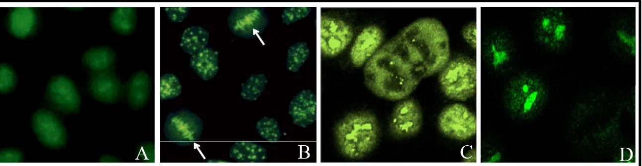 Figure 3. Patrons d’immunofluorescence indirecte sur cellules HEp-2 des auto-anticorps 