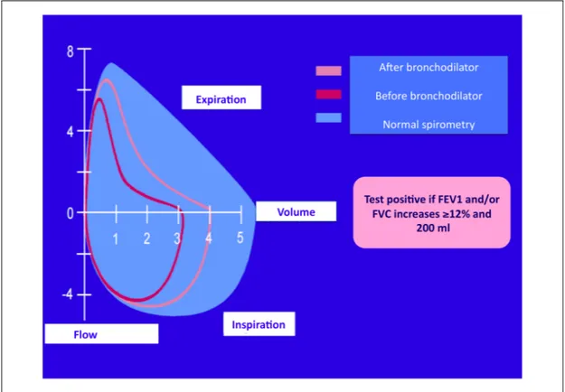 Figure 3: Flow volume curves during bronchodilator test   982 