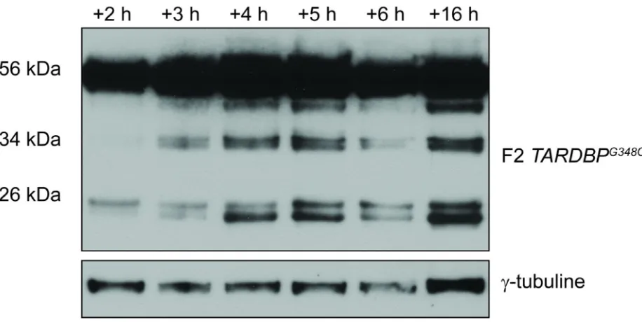 Figure 7. Expression du transgène à différents intervalles de temps, suite à un choc  thermique des embryons de  la lignée F2 TARDBP G348C 