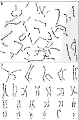 Figure 4: a) métaphase et b) caryotype en 