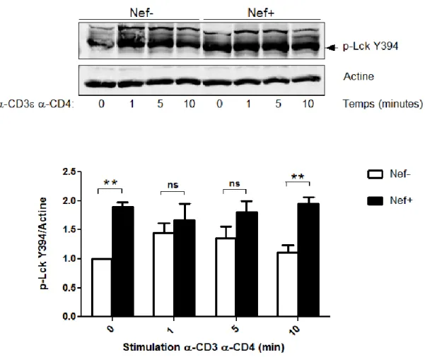 Figure  11A : Altération  de  la  dégradation  de  la  forme  active  Lck  Y394  dans  les  thymocytes CD4C/HIV Nef 