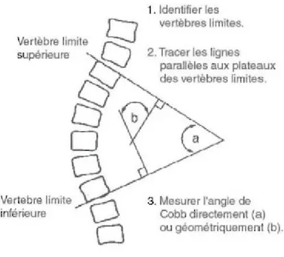 Figure 2 – Ligne de plomb sagittale à partir de C7.   