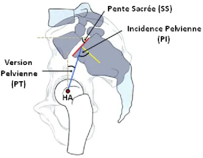 Figure 6 – Incidence pelvienne (PI), version pelvienne (PT), pente sacrée (SS).  La  somme arithmétique de la version pelvienne et de la pente sacrée correspond à 