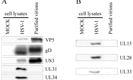 Figure 5 –Western blotting analysis of the capsid 