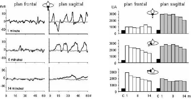 Figure 14 : Posteffets posturaux consécutifs à la contraction de groupes musculaires cervicaux