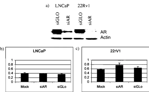 Figure  4.  AR  down-regulation  does  not  modulate  the  efficacy  of  IP6  in  prostate cancer cells endogenously expressing the AR
