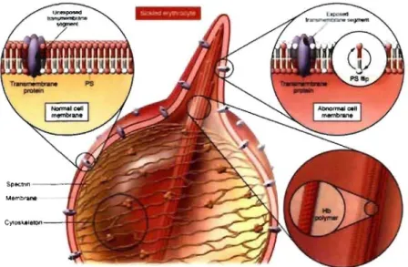 Figure  10.  Alterations  of  the  RBC  membrane  by  polymers  of  sickJe  hemoglobin