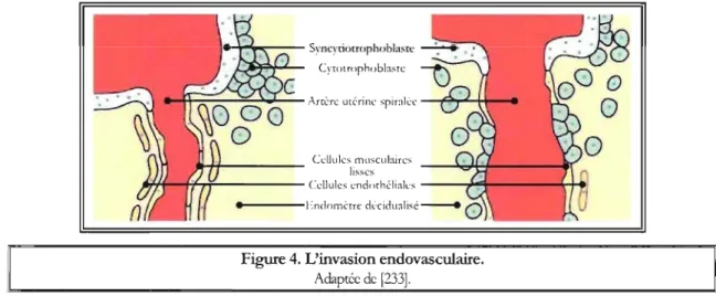 Figure  4. L'invasion endovasculaire. 