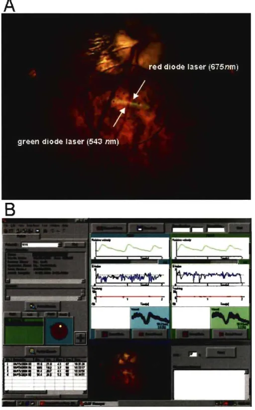 Figure 9:  Example  of a  CLBF measurement obtained  from  a  nonnal  subject.  The panel  (A)  illustrates  the  position of the  red diode  laser (675  nm)  that measures the  me an  centre  line  blood  colurnn  velocity  of  the  infero-temporal  retinal  artery  (ITRA)  and  the 