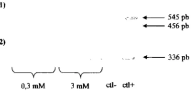 Figure 3.28. Expression de /'ARNm du GIPR dans les HeLa en présence de 0,3 mM ou de  3 mM 