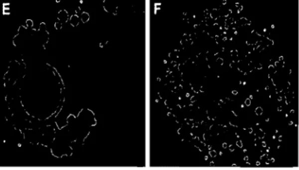 Figure  1.3  - Remodelage  de  la gouttelette lipidique chez  des  cellules  3T3-Ll  par im- im-munoftuorescence
