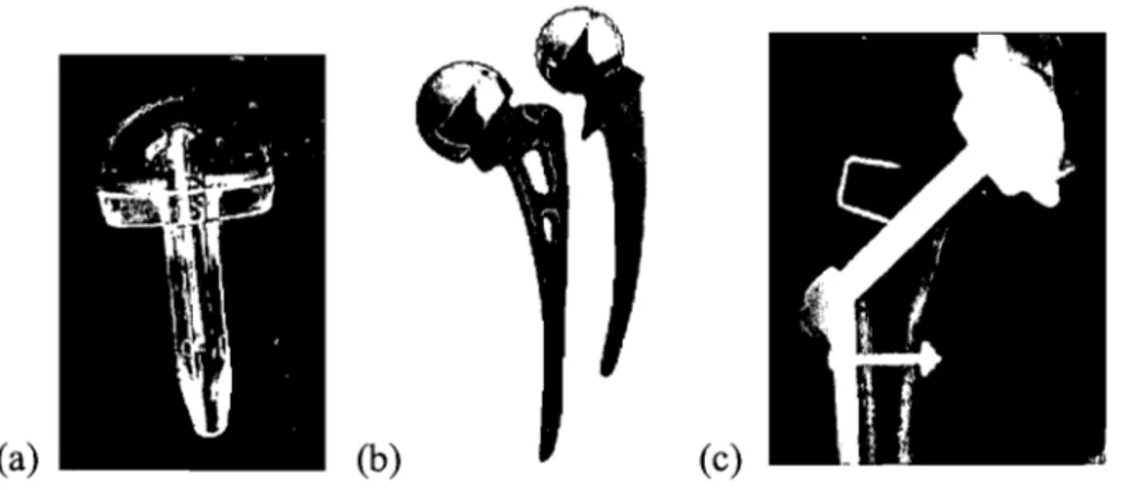 Figure 2:  Prothèse fémorale:  des frères Judet (a),  de  Thompson (droite)  et de Moore  (gauche)  (b)  ainsi que la prothèse de  Wiles  (c)